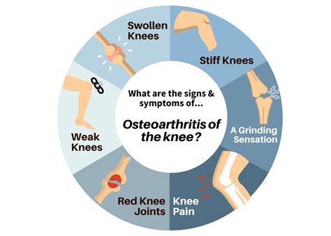 How To Treat Osteoarthritis Oa Of The Knee Pedes Orange County