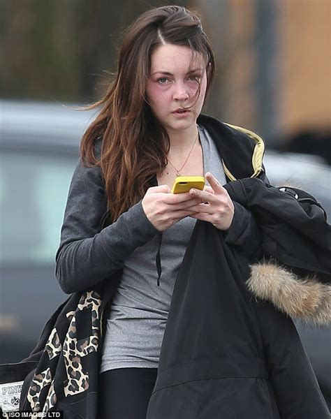 Eastenders Star Lacey Turner Steps Out After Confirming Stacey Slater