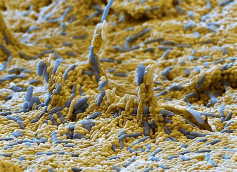 Bacteria And Fungus Seen In The Scanning And Transmission Electron