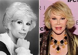 Joan Rivers Before and after surgeries and her death
