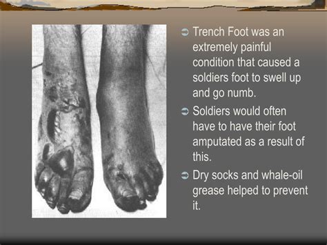 Ppt Trench Warfare Powerpoint Presentation Free Download Id1402601