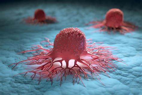 Research Into “achilles Heel” Of Cancer Tumors Paves Way For New