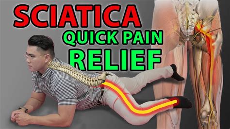 One Minute Sciatica Exercise To Cure Sciatica And Quick Pain