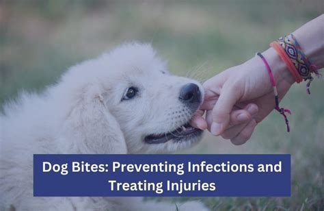 Dog Bites Preventing Infections And Treating Injuries Er Of Dallas
