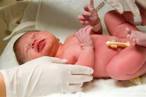 Outie Belly Button In Newborns Causes Symptoms Treatment