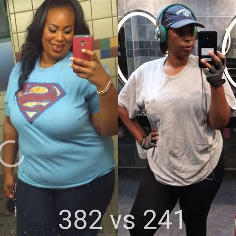 gastric bypass before and after black women