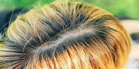 How To Touch Up Roots On Bleached Hair At Home Hair Explainer