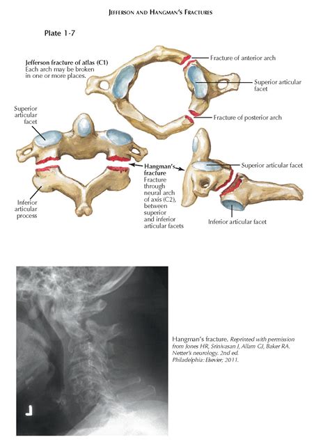 Clinical Problems And Correlations Of Craniovertebral Junction