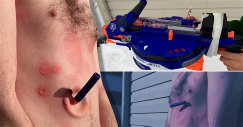 Guy Rewired His Nerf Gun For Extra Fire Power Metro News