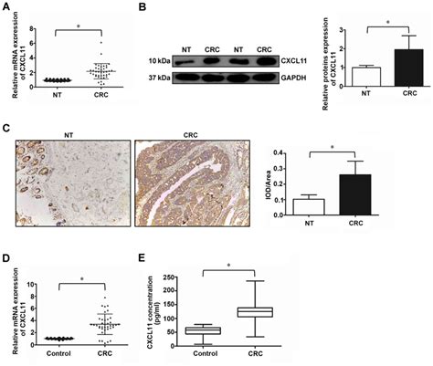 microrna‑144 mediates chronic inflammation and tumorigenesis in colorectal cancer progression