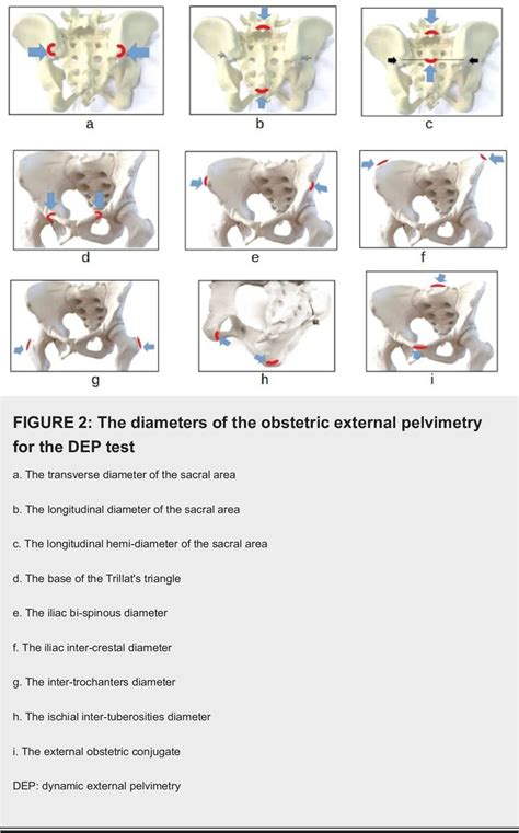 Table 1 From A Postural Approach To The Pelvic Diameters Of Obstetrics