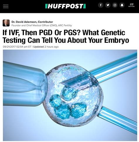 If Ivf Then Pgd Or Pgs What Genetic Testing Can Tell You About Your Embryo Arc Fertility