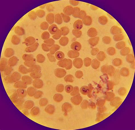 Veterinary Parasitology Babesiosis