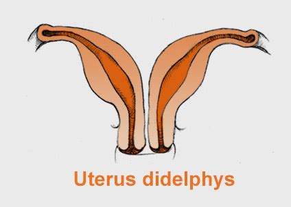 Abnormalities Of The Uterus Babycenter Canada