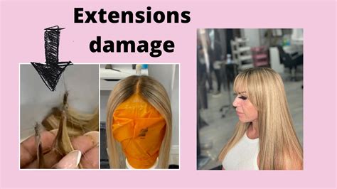 Crown Hair Loss System Bad Hair Extensions Ripped Her Hair Out