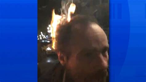 Crackhead Lights Hair On Fire Video Deemed Despicable Ctv News