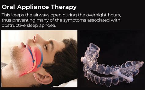 A Dentist Can Help With Sleep Apnoea Treatment New Road Dental In Bromsgrove Private And Nhs