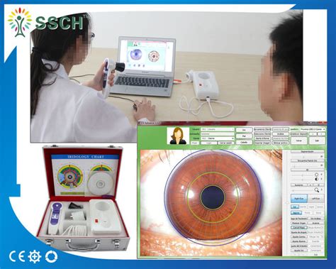 Mp High Resolution Iriscope Iridology Camera Usb Skin Scanner