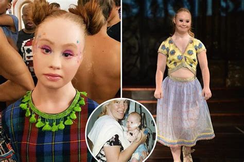 Down S Syndrome Model Who Battled Weight Woes And Struggled To Keep Up With Pals Finally