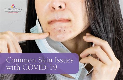 Common Skin Issues With Covid 19 Trillium Creek Dermatology