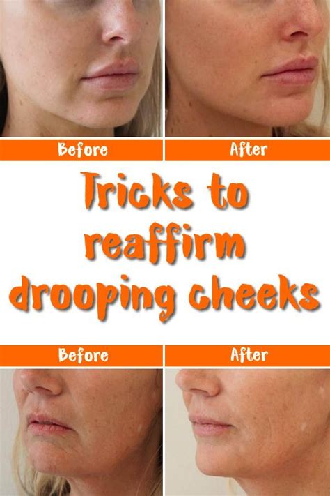 Here Are 4 Effective Ways To Get Rid Of Sagging Cheeks Facial