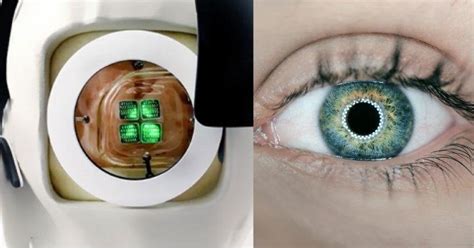 Doctors Build Worlds First Bionic Eye That Can Make 100 Blind People