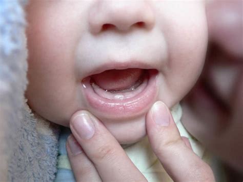 When Do Baby Teeth Come In All You Ever Wanted To Know Caring Parents Choice