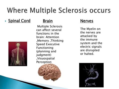 Ppt Multiple Sclerosis Powerpoint Presentation Id1867144