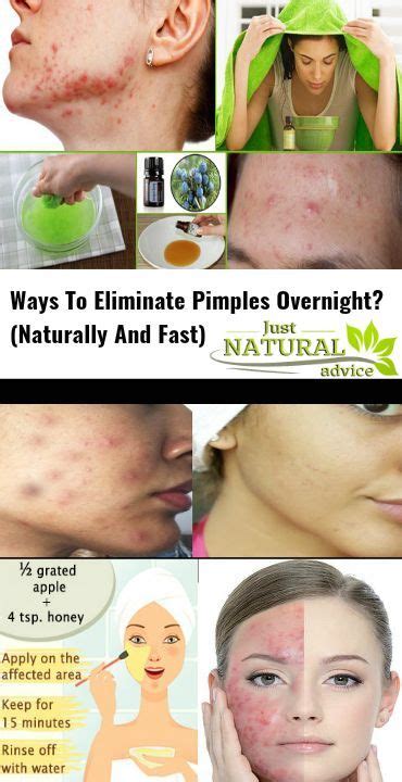 The Appearance Of A New Red And Swollen Pimple On The Face During The