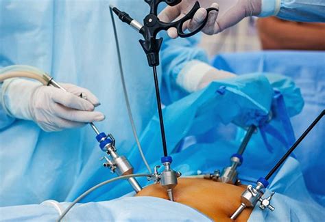 General And Laparoscopic Surgery Dsm Multispecialty Hospital