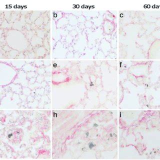 Mwcntg Promote The Emt Through The Tgf Mediated Akt Gsk Snail