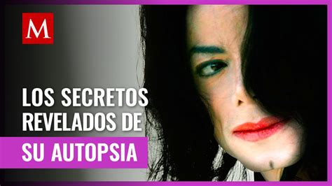 Michael Jackson Qué Dice Su Autopsia Grupo Milenio