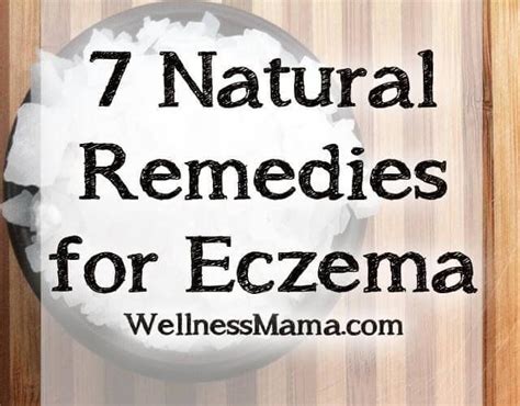 7 Natural Remedies For Eczema With Images Natural Eczema Remedies