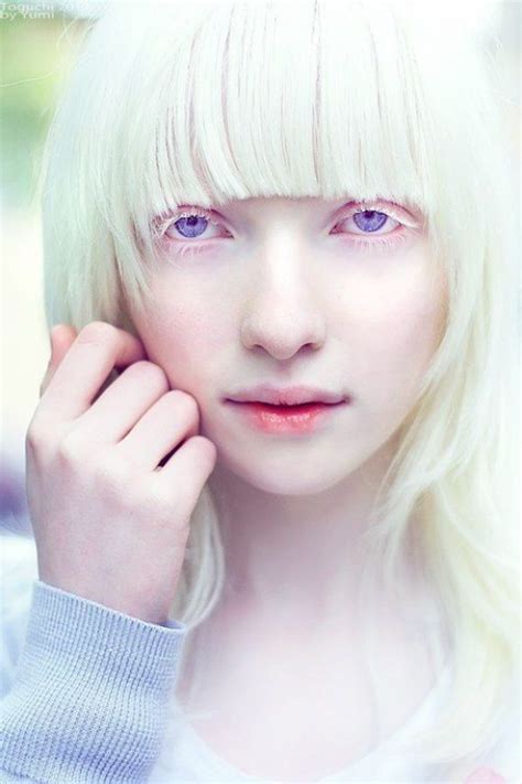 The Gorgeous Russian Albino Model Nastya Kiki Zhidkova Kumarov Is Her St Photograph