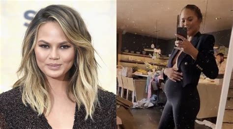 Chrissy Teigen Reveals She Was Pregnant During Breast Implant Removal Surgery But Didnt Know At