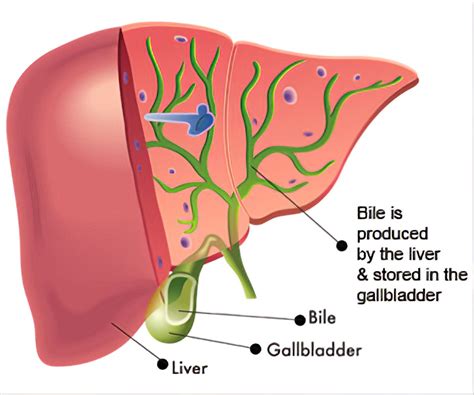 Sclerosing Cholangitis