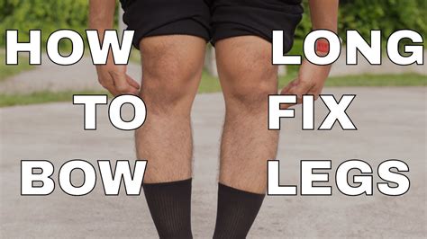 Yoga For Bow Legs How Long To Fix Bow Legs In Adults In Youtube