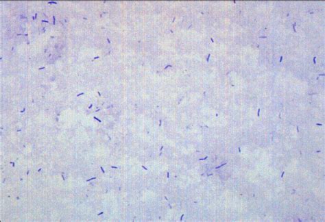 Eisco Prepared Microscope Slide Bacillus Smear Gram Positive