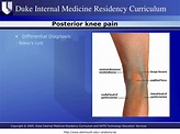 PPT - Knee Pain PowerPoint Presentation - ID:4778048