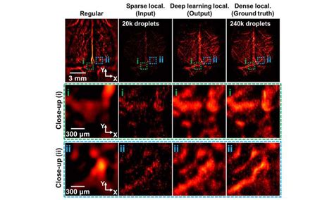 Artificial Intelligence Technology Accelerates Super Resolution