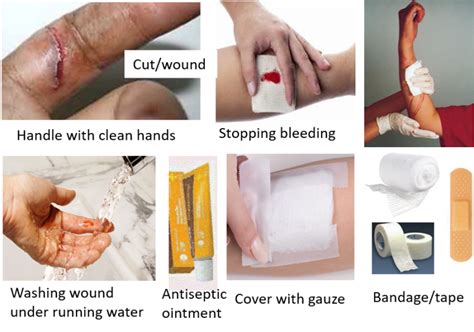 First Aid For Household And Common Injuries