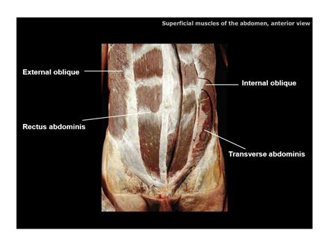 External Oblique Muscle Cadaver