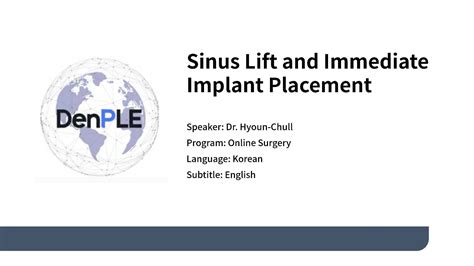 Sinus Lift And Immediate Implant Placement Advanced Dental Implant