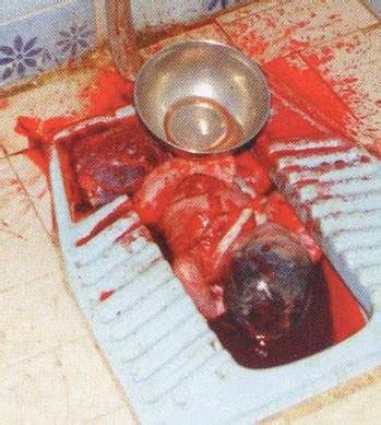 Usia 9 bulan bagi bayi adalah usia pertumbuhan di mana si kecil akan membutuhkan asupan makanan yang lebih. SinarMawaddah: Fakta Kes Buang Bayi | DARAH PERJUANGAN KE ...