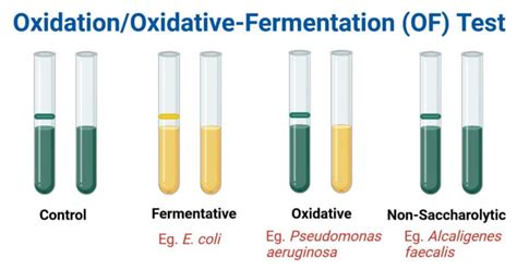of test oxidation oxidative fermentation fermentative test