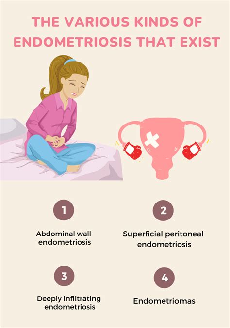 What To Do If You Have Endometriosis