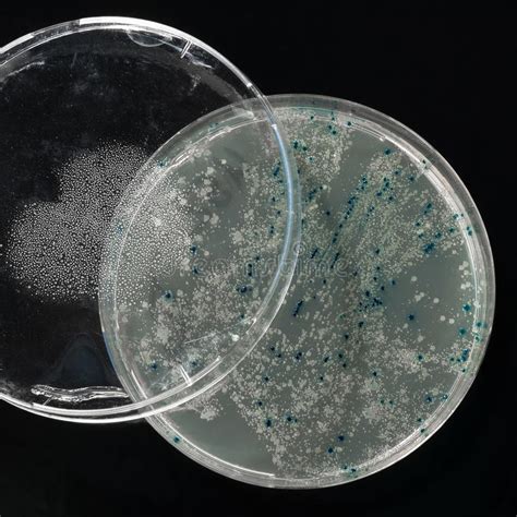 Agar Plate With Bacterial Colonies On Black Stock Image Image Of