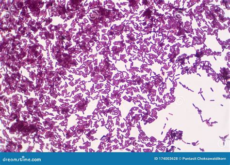 Bacillus Gram Positive Stain Under Microscope View Bacillus Is Rod D