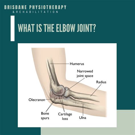 10 Diagram Of Elbow Bones SolehFearne