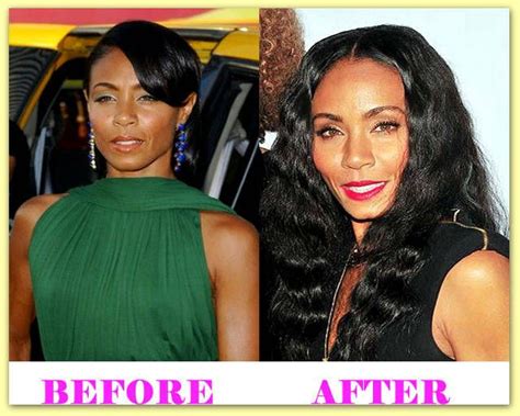 Jada Pinkett Smith Plastic Surgery Before And After